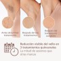 Philips Lumea serie 8000, dispositivo de depilación IPL, alternativa al láser, SenseIQ, 3 accesorios para cuerpo, cara y zonas