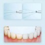 XIAOMI MIJIA MEO703 irrigador Oral portátil F300 chorro de agua Dental