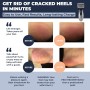 Lima-Electrónica para el Cuidado de los Pies de Hombres Own Harmony - Profesional y Poderoso - Recargables Aparato de Pedicura