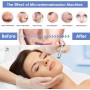 45W Dispositivo profesional de dermoabrasión, 65-68cmHg Dispositivo de microdermoabrasión, microdermoabrasión de diamante,