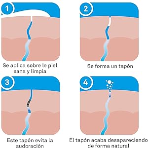 como funciona
